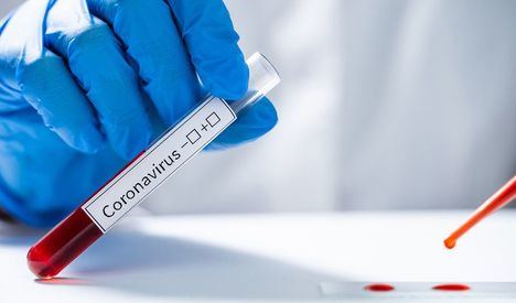 Los cinco casos en investigación por coronavirus de ayer dan resultado negativo