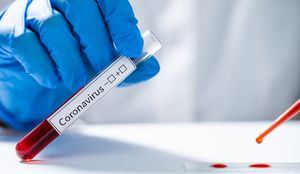 Castilla-La Mancha registra 23 nuevos casos por infección de coronavirus