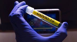 Coronavirus.- Castilla-La Mancha llama a 