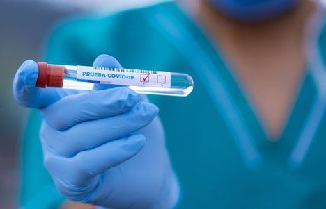 Coronavirus.- Los nuevos casos detectados en Castilla-La Mancha llegan a 909 y el número de fallecidos suma 7 en las últimas 24 horas