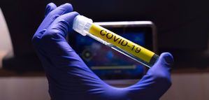 Coronavirus.- Los nuevos casos bajan en Castilla-La Mancha a 277 y los ingresados en UCI a 87 pero el número de fallecidos aumenta a 18