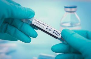 Coronavirus.- El número de casos y de hospitalizaciones en cama convencional descienden por debajo de 500 en Castilla-La Mancha