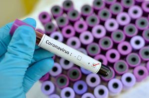 Coronavirus.- Vuelven a bajar los nuevos casos en Castilla-La Mancha, que también experimenta un descenso de hospitalizados y muertes