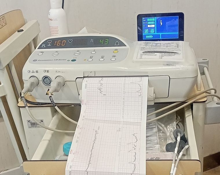 Hospital de Villarrobledo incorpora un nuevo sistema de monitorización para las gestantes que mejora la seguridad