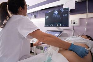 La GAI de Albacete se dota de un ecógrafo de alta gama para optimizar los diagnósticos prenatales